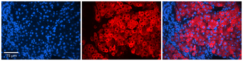 FGFR1OP Rabbit Polyclonal Antibody