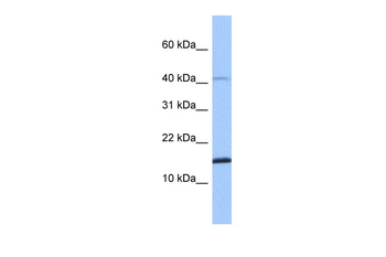 SPAG11B Rabbit Polyclonal Antibody