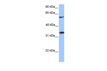 TSKS Rabbit Polyclonal Antibody