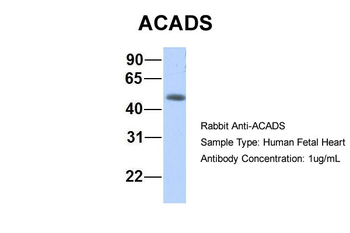ACADS Rabbit Polyclonal Antibody