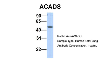 ACADS Rabbit Polyclonal Antibody