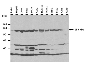 ERCC5 Rabbit Polyclonal Antibody