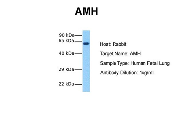AMH Rabbit Polyclonal Antibody