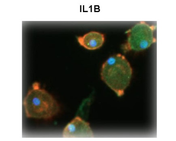 IL1B Rabbit Polyclonal Antibody