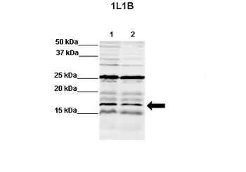 IL1B Rabbit Polyclonal Antibody
