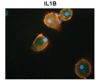 IL1B Rabbit Polyclonal Antibody