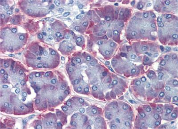 IMPDH1 Rabbit Polyclonal Antibody