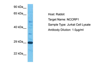 NCCRP1 Rabbit Polyclonal Antibody
