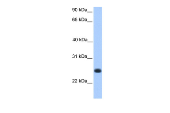 CCDC184 Rabbit Polyclonal Antibody
