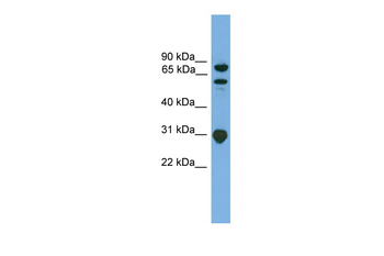 SH3KBP1 Rabbit Polyclonal Antibody
