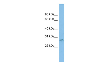 C1orf104 Rabbit Polyclonal Antibody