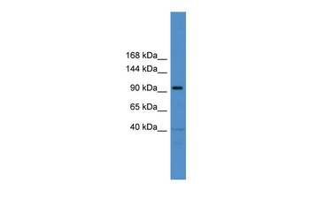 TRAK1 Rabbit Polyclonal Antibody
