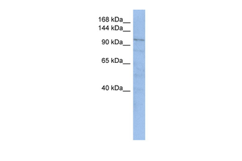 TRAK1 Rabbit Polyclonal Antibody