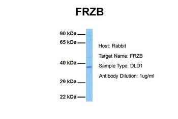 FRZB Rabbit Polyclonal Antibody