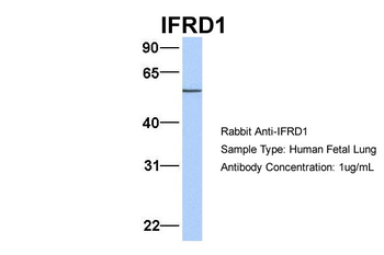 IFRD1 Rabbit Polyclonal Antibody