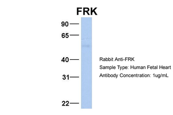 FRK Rabbit Polyclonal Antibody