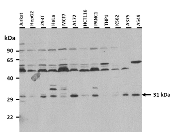 GCLM Rabbit Polyclonal Antibody