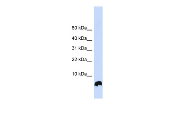 GLRX Rabbit Polyclonal Antibody