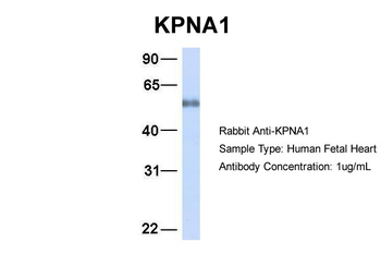 KPNA1 Rabbit Polyclonal Antibody