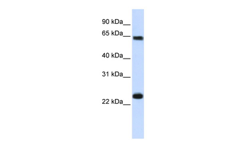 KPNA1 Rabbit Polyclonal Antibody