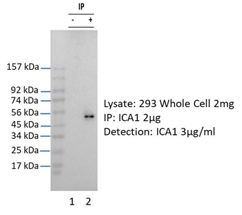ICA1 Rabbit Polyclonal Antibody