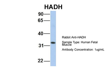 HADH Rabbit Polyclonal Antibody