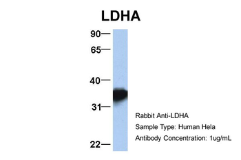 LDHA Rabbit Polyclonal Antibody