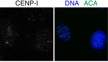 CENPI Rabbit Polyclonal Antibody