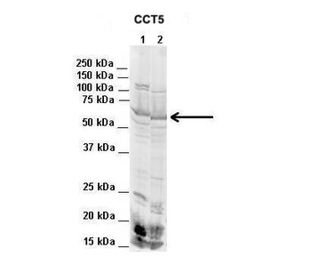CCT5 Rabbit Polyclonal Antibody
