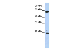 CCT5 Rabbit Polyclonal Antibody