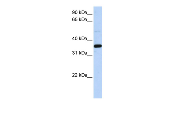 LTB4DH Rabbit Polyclonal Antibody