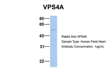 VPS4A Rabbit Polyclonal Antibody