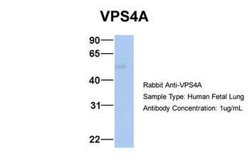 VPS4A Rabbit Polyclonal Antibody