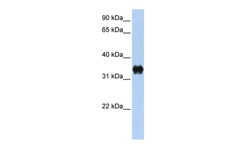 PYCR2 Rabbit Polyclonal Antibody