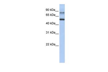 EPN1 Rabbit Polyclonal Antibody