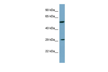 DKK1 Rabbit Polyclonal Antibody