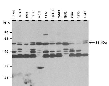 ADAMDEC1 Rabbit Polyclonal Antibody