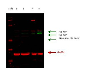 GLS Rabbit Polyclonal Antibody