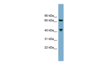 GLS Rabbit Polyclonal Antibody