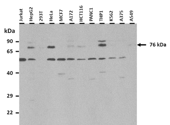 CPEB3 Rabbit Polyclonal Antibody