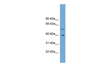 CLUAP1 Rabbit Polyclonal Antibody