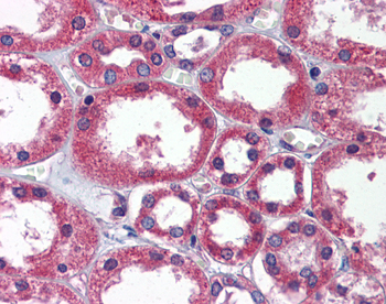 TBC1D1 Rabbit Polyclonal Antibody