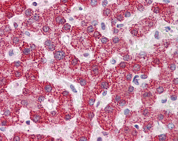 SH2B1 Rabbit Polyclonal Antibody