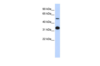 GDF2 Rabbit Polyclonal Antibody