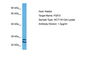 FGF21 Rabbit Polyclonal Antibody
