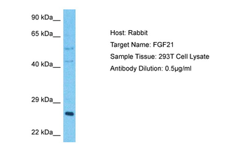 FGF21 Rabbit Polyclonal Antibody