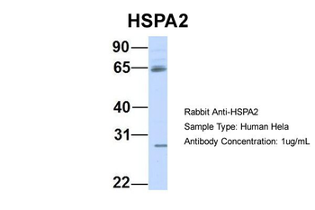 HSPA2 Rabbit Polyclonal Antibody