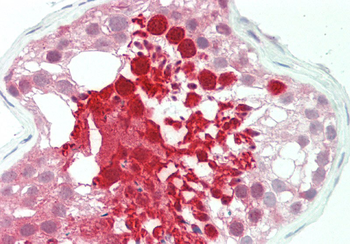 HSPA2 Rabbit Polyclonal Antibody