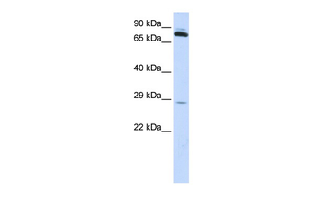 TPK1 Rabbit Polyclonal Antibody