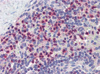 GABARAPL1 Rabbit Polyclonal Antibody
